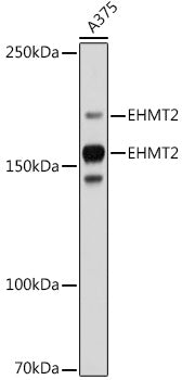 EHMT2 Rabbit mAb