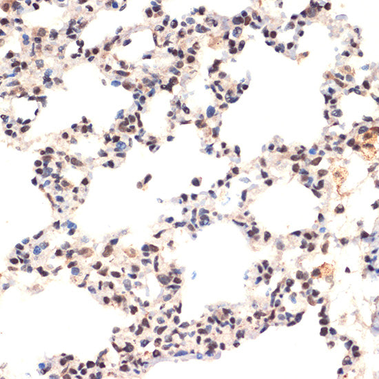 EHMT2 Rabbit mAb