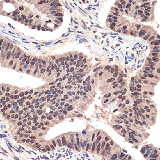 EHMT2 Rabbit mAb