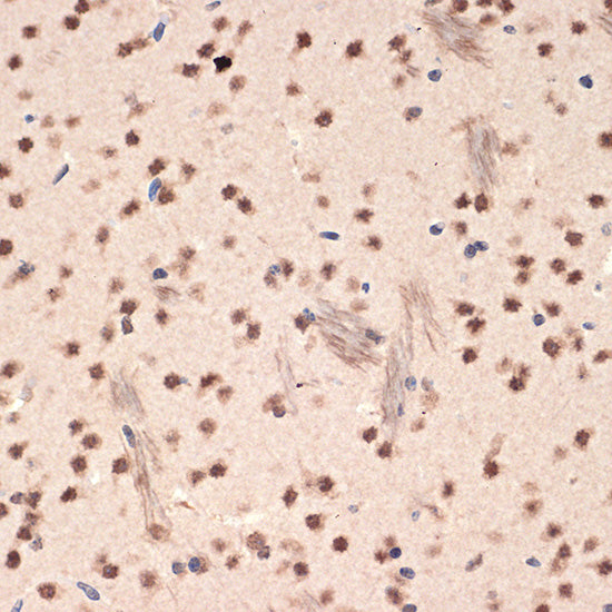 EHMT2 Rabbit mAb