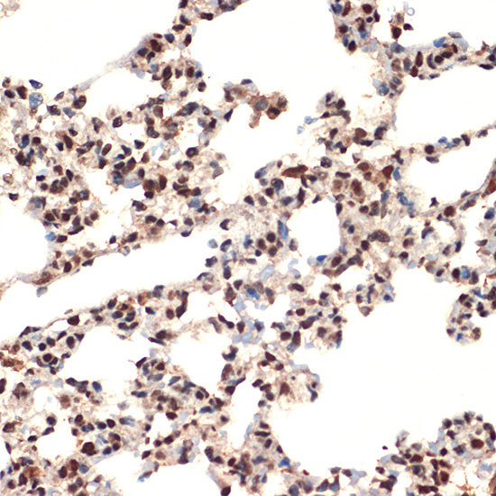 CIRBP Rabbit mAb