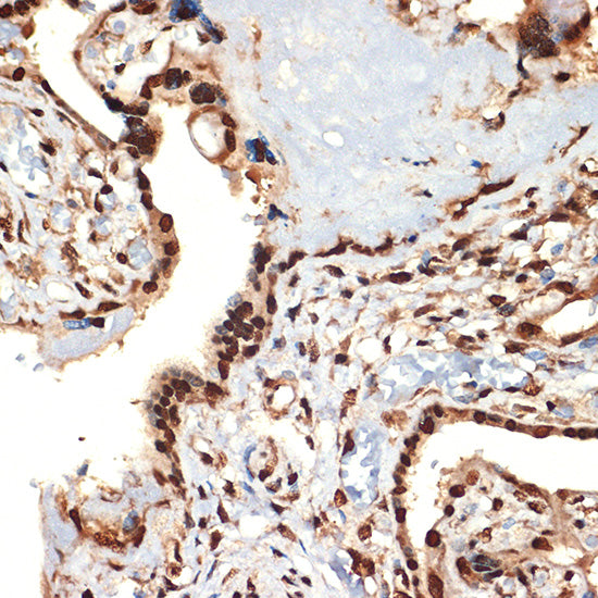 CIRBP Rabbit mAb
