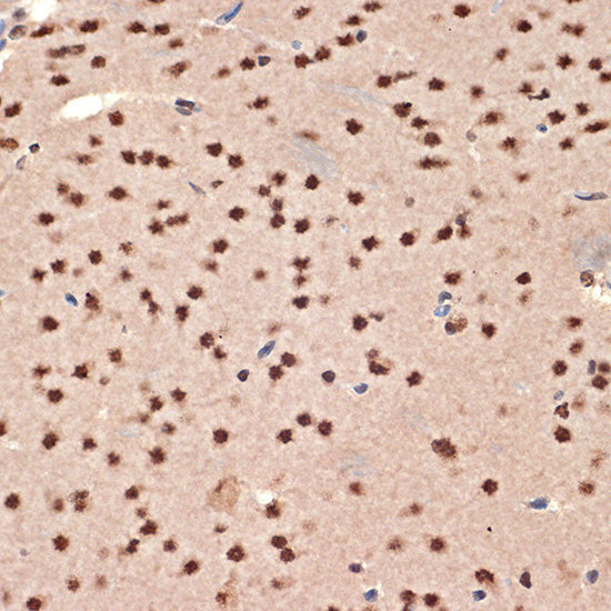CIRBP Rabbit mAb