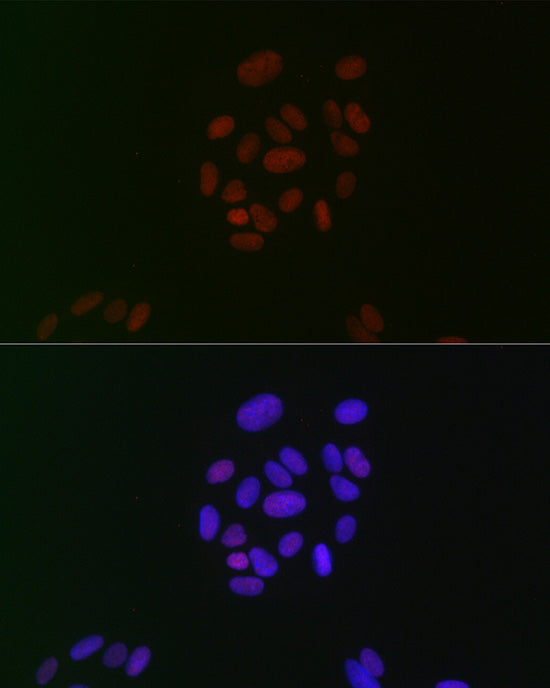 CIRBP Rabbit mAb