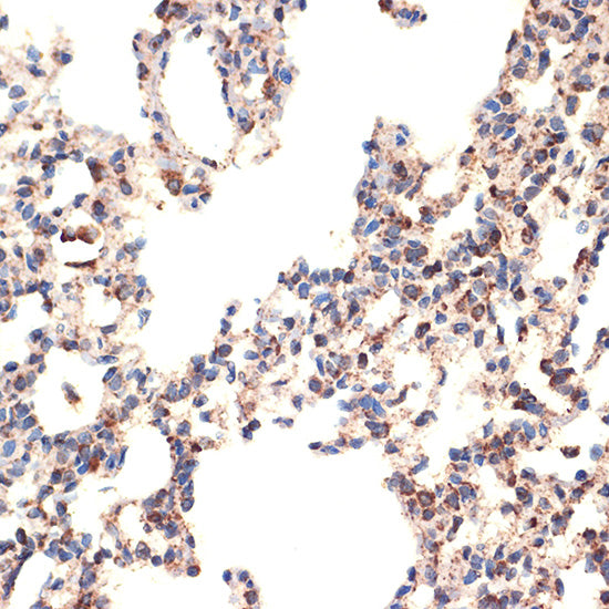 BCL2L14/BCLG Rabbit mAb