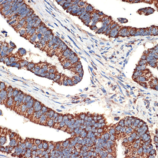 BCL2L14/BCLG Rabbit mAb