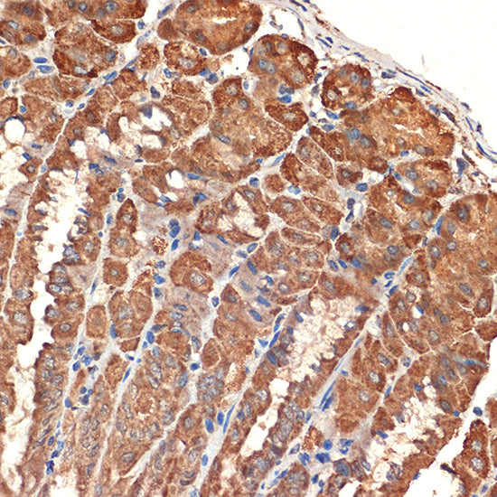 BCL2L14/BCLG Rabbit mAb
