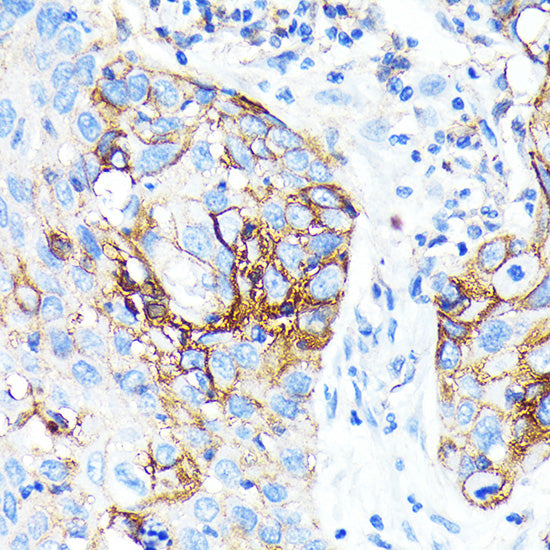ICAM-1/CD54 Rabbit mAb