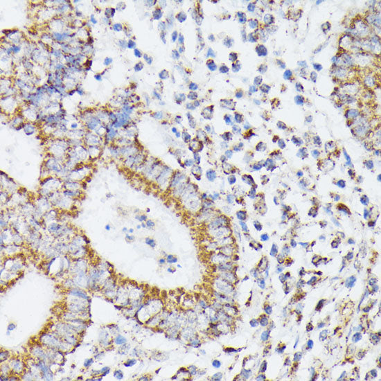 RHOG Rabbit pAb