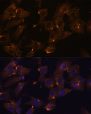 ARVCF Rabbit pAb