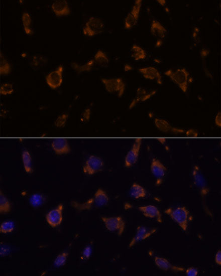 ARVCF Rabbit pAb