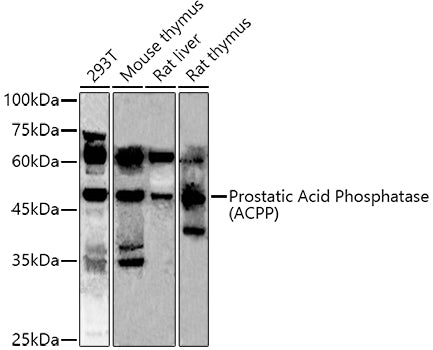 Prostatic Acid Phosphatase (ACPP) Rabbit pAb
