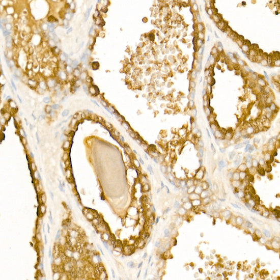 Prostatic Acid Phosphatase (ACPP) Rabbit pAb