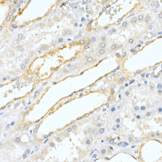 Prostatic Acid Phosphatase (ACPP) Rabbit pAb
