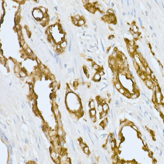 Prostatic Acid Phosphatase (ACPP) Rabbit pAb