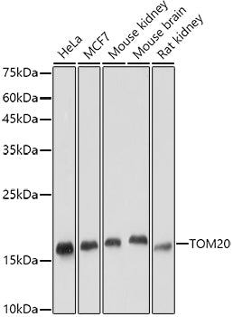 TOM20 Rabbit mAb