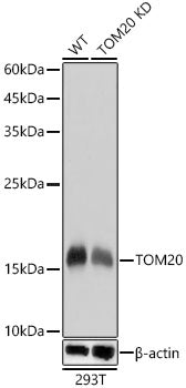 TOM20 Rabbit mAb