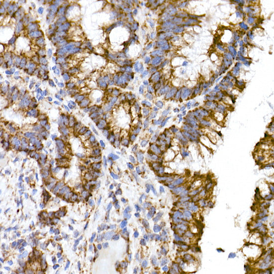 TOM20 Rabbit mAb