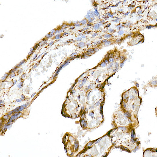 TOM20 Rabbit mAb