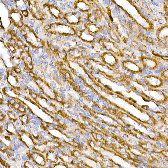 TOM20 Rabbit mAb