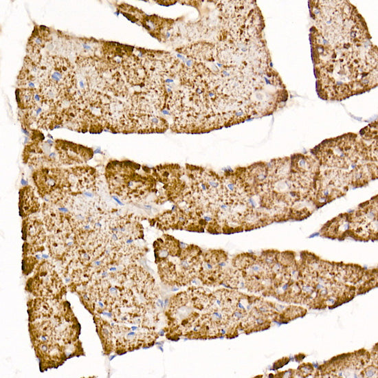 TOM20 Rabbit mAb