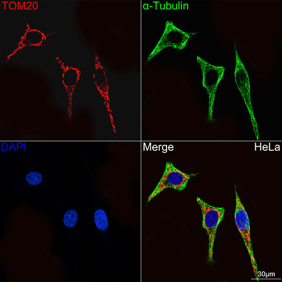 TOM20 Rabbit mAb