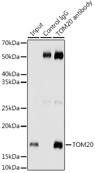 TOM20 Rabbit mAb