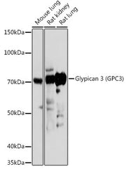 Glypican 3 (GPC3) Rabbit pAb