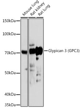 Glypican 3 (GPC3) Rabbit pAb