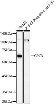 Glypican 3 (GPC3) Rabbit pAb