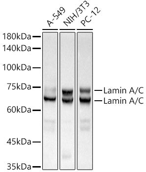 [KO Validated] Lamin A/C Rabbit mAb