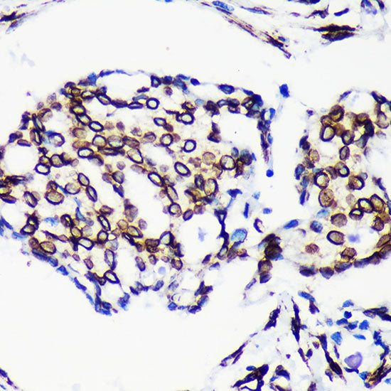 [KO Validated] Lamin A/C Rabbit mAb