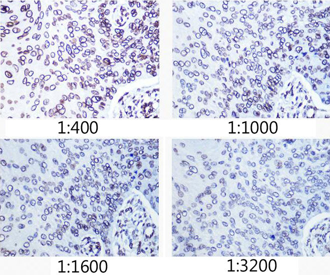 [KO Validated] Lamin A/C Rabbit mAb