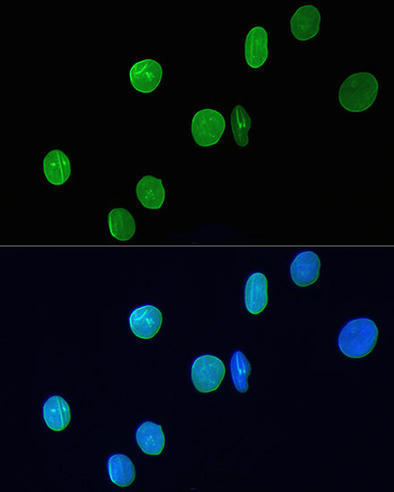[KO Validated] Lamin A/C Rabbit mAb