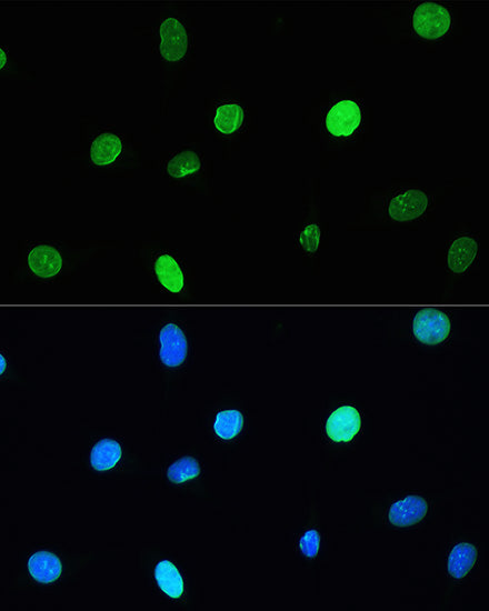 [KO Validated] Lamin A/C Rabbit mAb