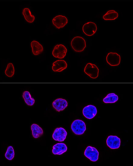 [KO Validated] Lamin A/C Rabbit mAb