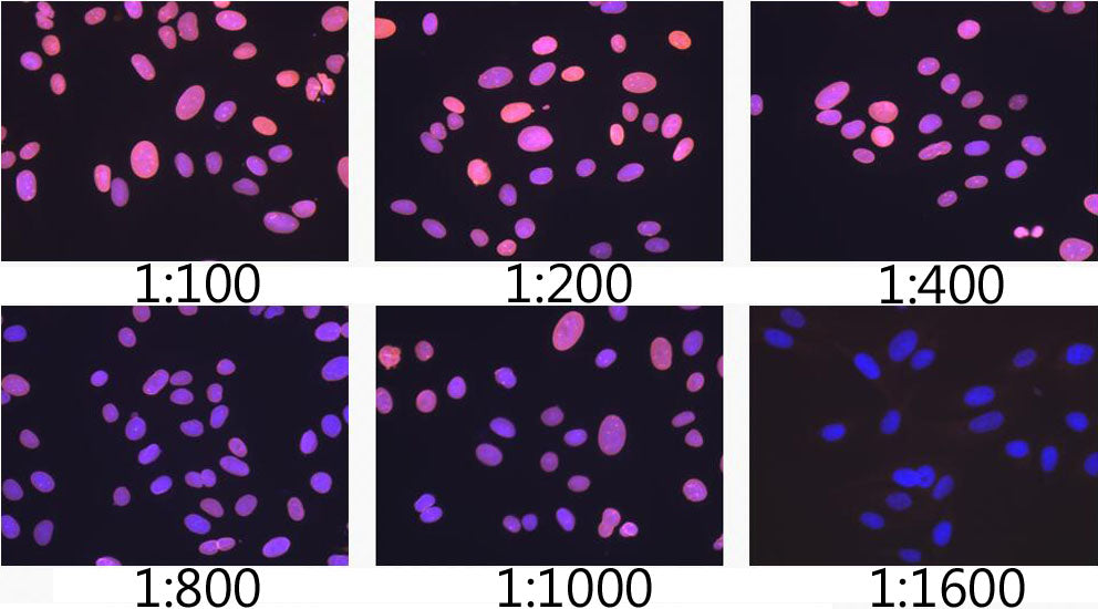 [KO Validated] Lamin A/C Rabbit mAb