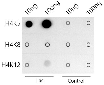 Acetyl-Histone H4-K5 Rabbit mAb