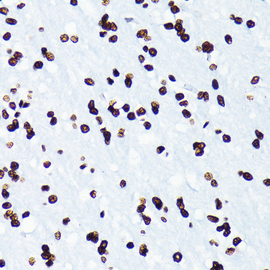 Acetyl-Histone H4-K5 Rabbit mAb