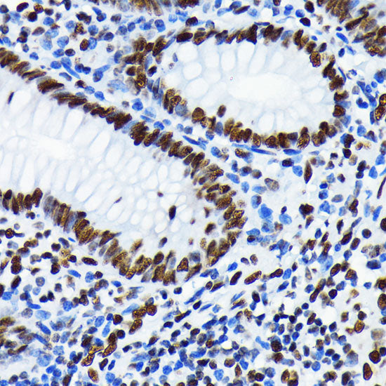 Acetyl-Histone H4-K5 Rabbit mAb