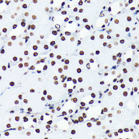 Acetyl-Histone H4-K5 Rabbit mAb