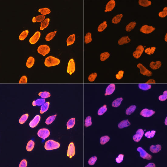 Acetyl-Histone H4-K5 Rabbit mAb