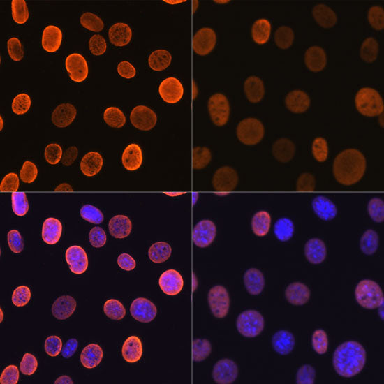 Acetyl-Histone H4-K5 Rabbit mAb