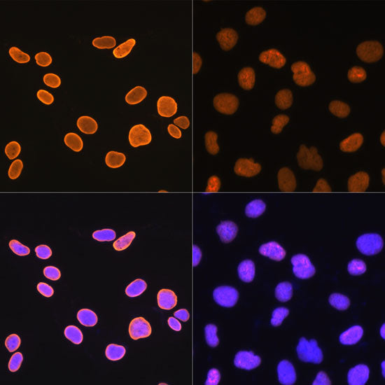 Acetyl-Histone H4-K5 Rabbit mAb