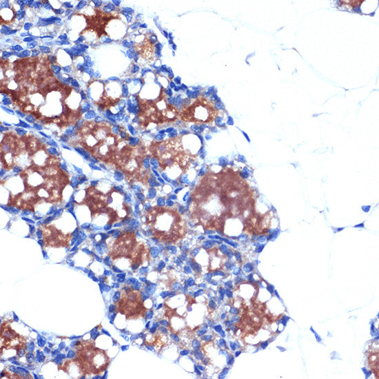 UCP1+UCP3 Rabbit mAb