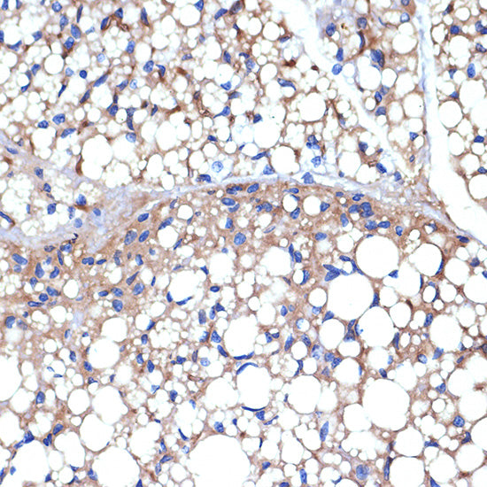 UCP1+UCP3 Rabbit mAb