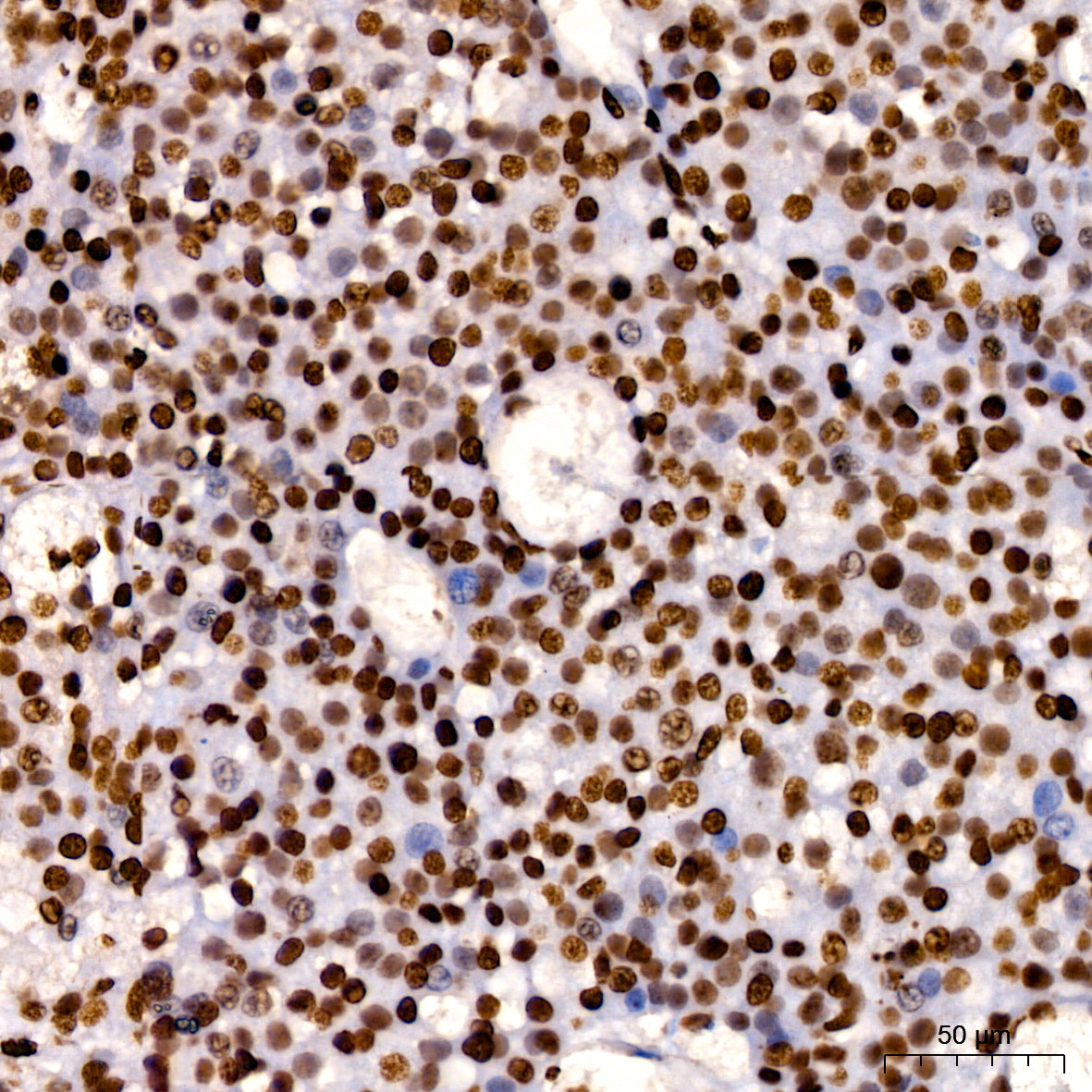[KO Validated] HMGB1 Rabbit mAb