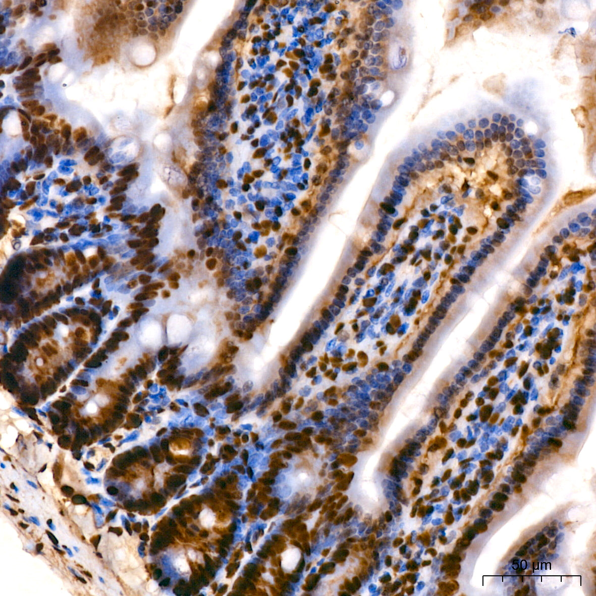 [KO Validated] HMGB1 Rabbit mAb