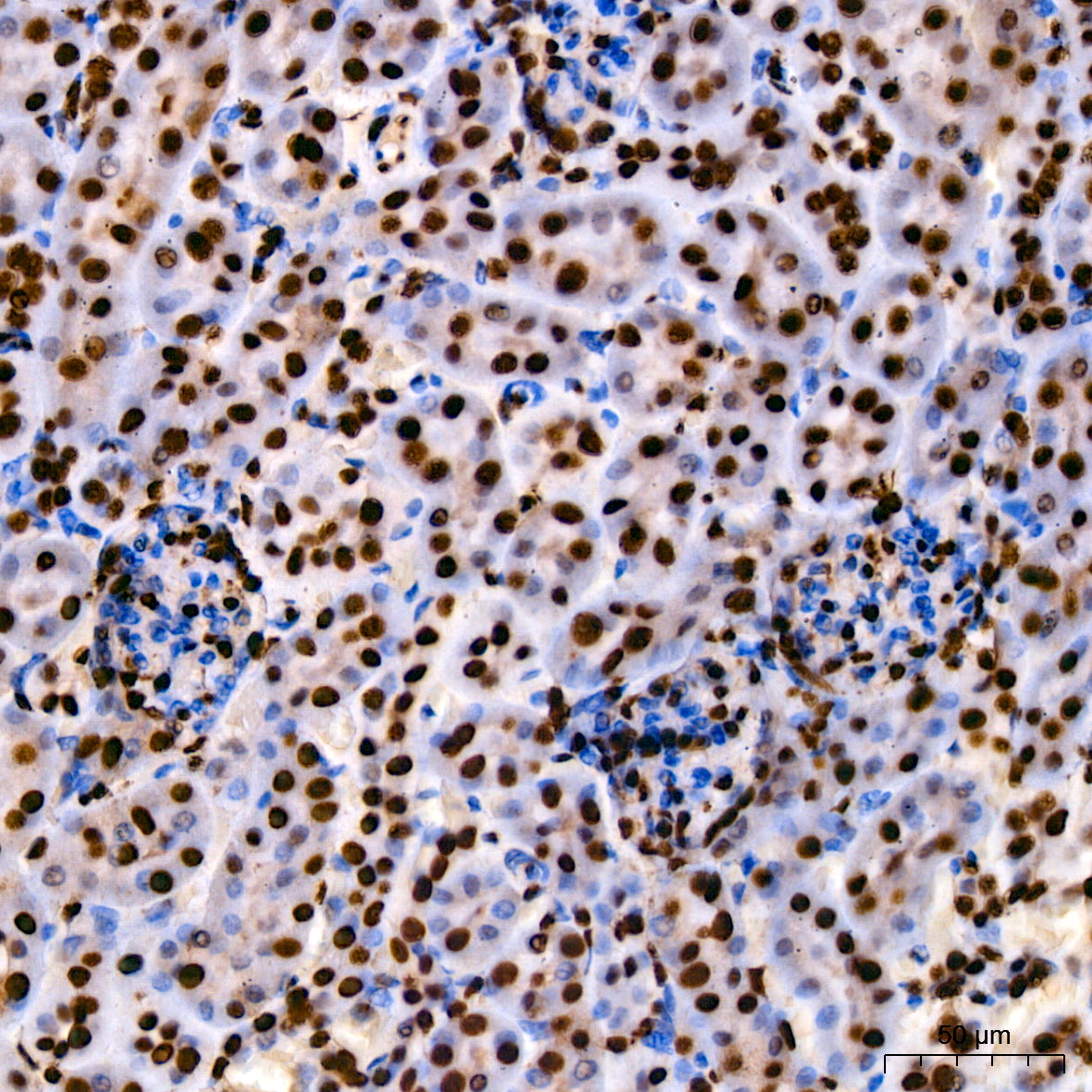 [KO Validated] HMGB1 Rabbit mAb
