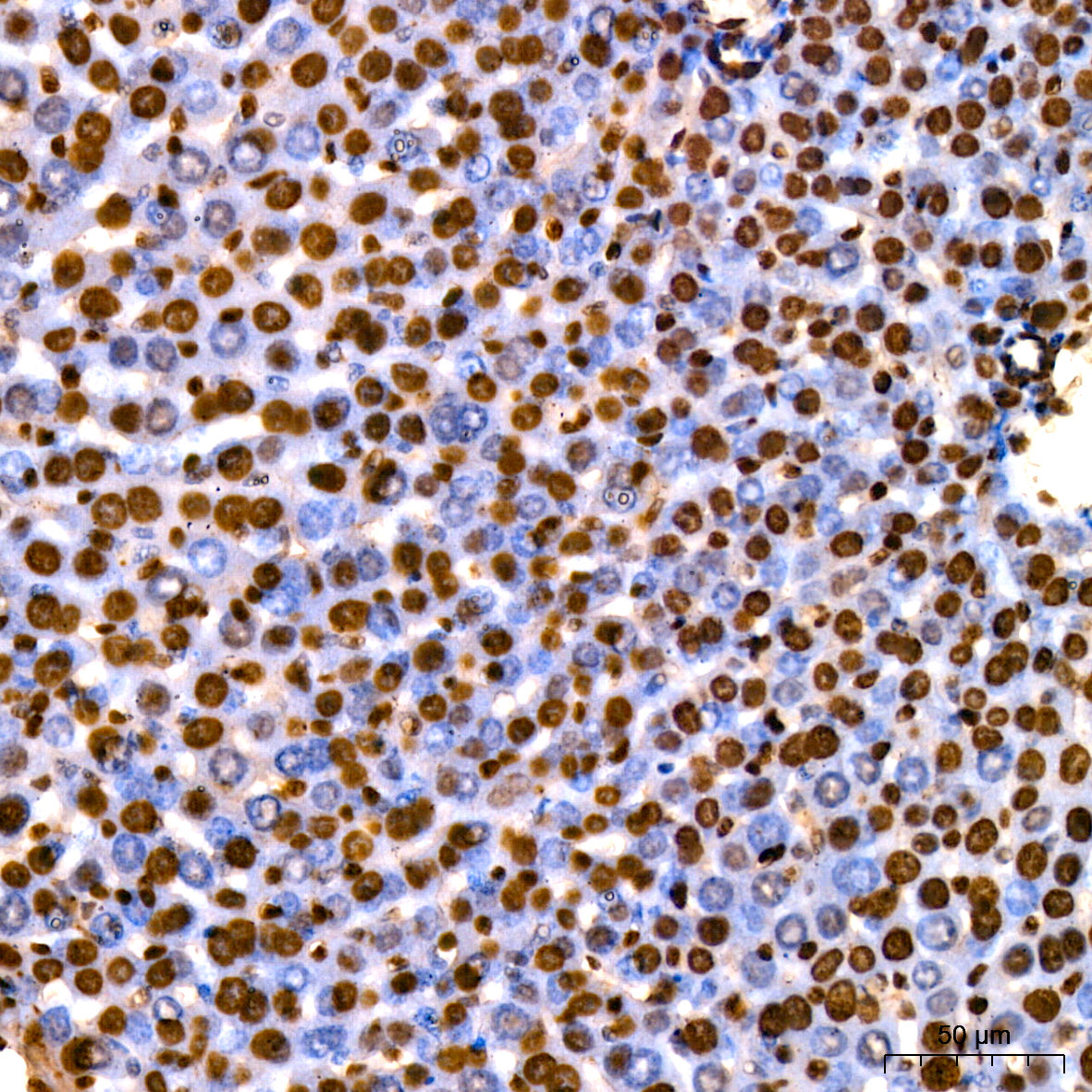 [KO Validated] HMGB1 Rabbit mAb